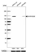 SH3PXD2B Antibody