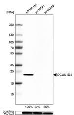 DCUN1D4 Antibody in Western Blot (WB)