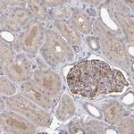 RWDD4 Antibody in Immunohistochemistry (IHC)