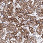 HIBCH Antibody in Immunohistochemistry (IHC)