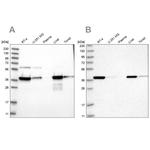 HIBCH Antibody in Western Blot (WB)