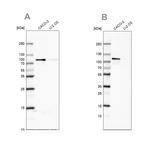 LAR4B Antibody in Western Blot (WB)