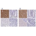 TPPP Antibody in Immunohistochemistry (IHC)