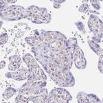 TPPP Antibody in Immunohistochemistry (IHC)