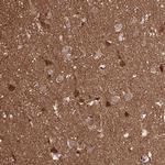 TPPP Antibody in Immunohistochemistry (IHC)