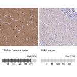 TPPP Antibody in Immunohistochemistry (IHC)