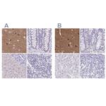 TPPP Antibody in Immunohistochemistry (IHC)