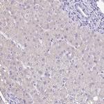 TPPP Antibody in Immunohistochemistry (IHC)