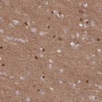 TPPP Antibody in Immunohistochemistry (IHC)