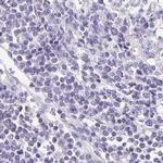 TPPP Antibody in Immunohistochemistry (IHC)