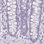 TPPP Antibody in Immunohistochemistry (IHC)