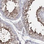 DPCD Antibody in Immunohistochemistry (IHC)