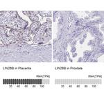 LIN28B Antibody in Immunohistochemistry (IHC)