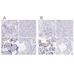 LIN28B Antibody in Immunohistochemistry (IHC)