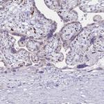 LIN28B Antibody in Immunohistochemistry (IHC)