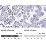 LIN28B Antibody