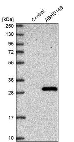 ABHEB Antibody in Western Blot (WB)