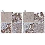 SUCLG1 Antibody in Immunohistochemistry (IHC)