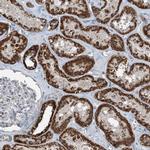 SUCLG1 Antibody in Immunohistochemistry (IHC)