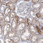 LZK Antibody in Immunohistochemistry (IHC)