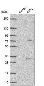 KIP2 Antibody in Western Blot (WB)