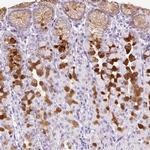 TFF2 Antibody in Immunohistochemistry (IHC)