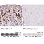 TFF2 Antibody