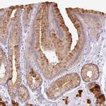 TFF2 Antibody in Immunohistochemistry (IHC)