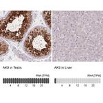 Adenylate Kinase 9 Antibody in Immunohistochemistry (IHC)