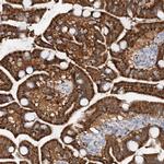 PTGR1 Antibody in Immunohistochemistry (IHC)