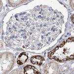 PDHB Antibody in Immunohistochemistry (IHC)