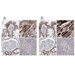 PDHB Antibody in Immunohistochemistry (IHC)