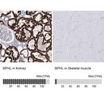 BPHL Antibody in Immunohistochemistry (IHC)