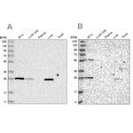 BPHL Antibody in Western Blot (WB)