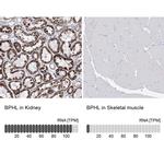 BPHL Antibody in Immunohistochemistry (IHC)