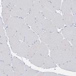 BPHL Antibody in Immunohistochemistry (IHC)