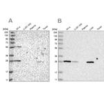 BPHL Antibody in Western Blot (WB)