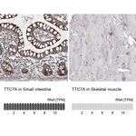 TTC7A Antibody in Immunohistochemistry (IHC)