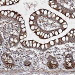 TTC7A Antibody in Immunohistochemistry (IHC)