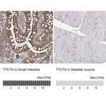 TTC7A Antibody