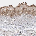 SH3BP2 Antibody in Immunohistochemistry (IHC)