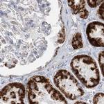 PCCB Antibody in Immunohistochemistry (IHC)