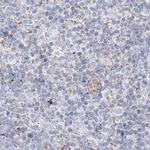 PCCB Antibody in Immunohistochemistry (IHC)