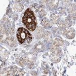 PCCB Antibody in Immunohistochemistry (IHC)