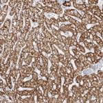 PCCB Antibody in Immunohistochemistry (IHC)