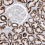 PCCB Antibody in Immunohistochemistry (IHC)