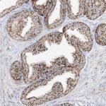 PCCB Antibody in Immunohistochemistry (IHC)