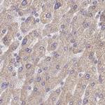 BITE Antibody in Immunohistochemistry (IHC)