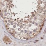 BITE Antibody in Immunohistochemistry (IHC)