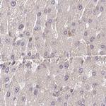 BITE Antibody in Immunohistochemistry (IHC)